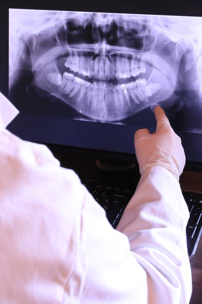 Best Broken or Cracked Tooth Emergency Dentist in Burnettown, SC