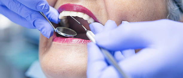 Best Emergency Dentist for Knocked-Out Tooth in Burnettown, SC